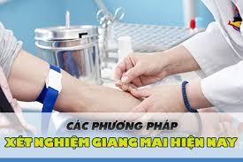 Các phương pháp xét nghiệm giang mai hiện nay