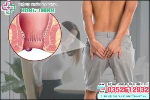 Dấu hiệu bệnh trĩ ngoại