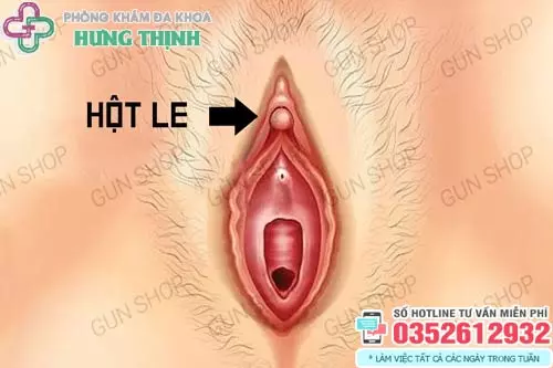 Hột le nằm ở vị trí nào?