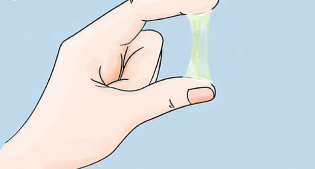Dấu hiệu nhận biết bệnh viêm phụ khoa