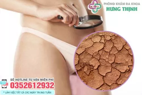 Nguyên nhân khiến cô bé bị khô hạn