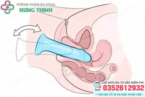 Quan hệ chạm vào cổ tử cung có sao không?