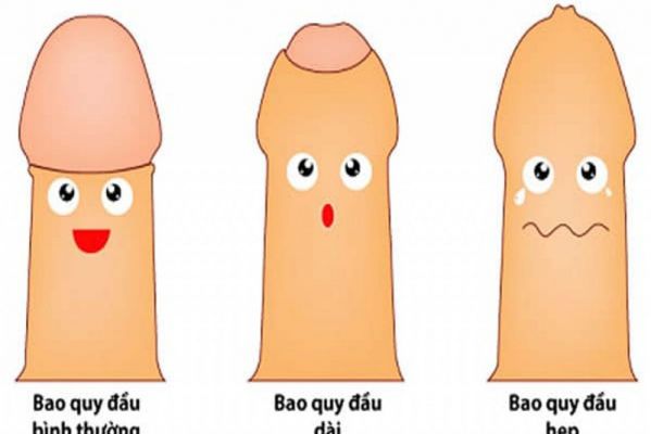 Bao quy đầu là gì? Những bệnh thường gặp ở bao quy đầu