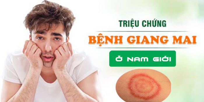 Bệnh giang mai ở nam giới: Dấu hiệu nhận biết, cách điều trị