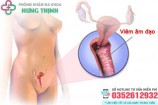 10 Cách chữa viêm âm đạo tại nhà hiệu quả cho nữ giới