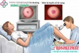 11 Cách chữa viêm lộ tuyến cổ tử cung tốt nhất tại nhà hiệu quả