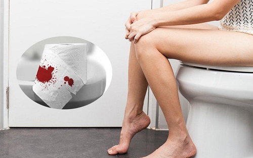 9 Nguyên nhân gây đi ngoài ra máu bạn cần biết