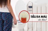 Đi tiểu ra máu là bệnh gì? Các nguyên nhân gây tiểu ra máu