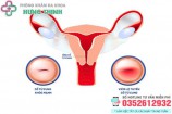 10 Địa chỉ chữa đốt viêm lộ tuyến cổ tử cung ở đâu tốt Hà Nội