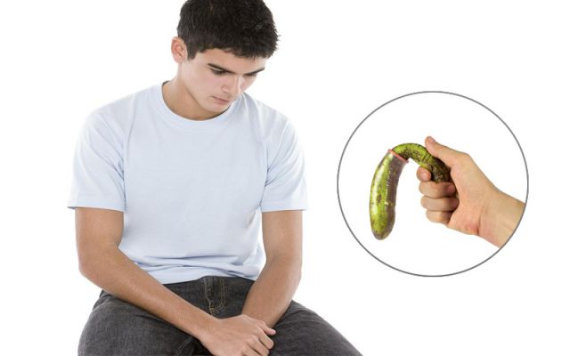 TOP 8 cách chữa rối loạn cương dương tại nhà không cần thuốc