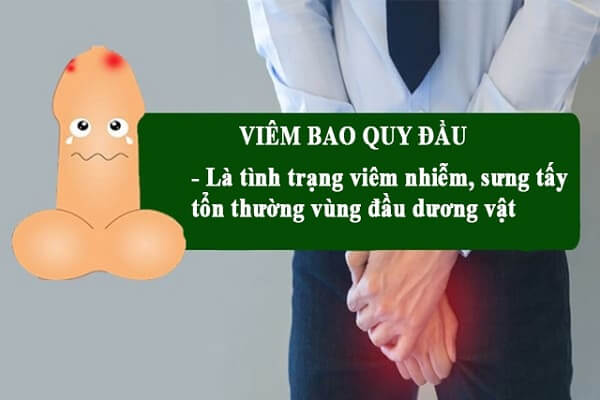 Viêm bao quy đầu: Nguyên nhân dấu hiệu và cách điều trị