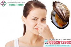 Khí hư có mùi hôi là bị gì? Cách chữa khí hư có mùi hôi
