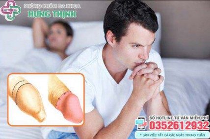 Top 12 địa chỉ cắt bao quy đầu ở đâu tốt nhất Hà Nội uy tín