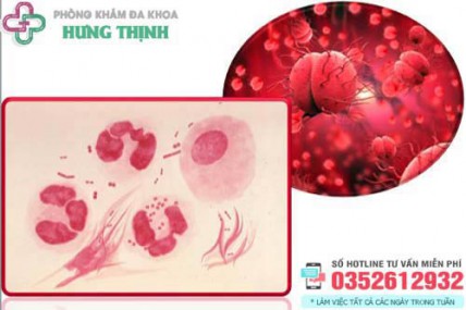 Chi phí chữa bệnh lậu hết bao nhiêu tiền giá khám xét nghiệm