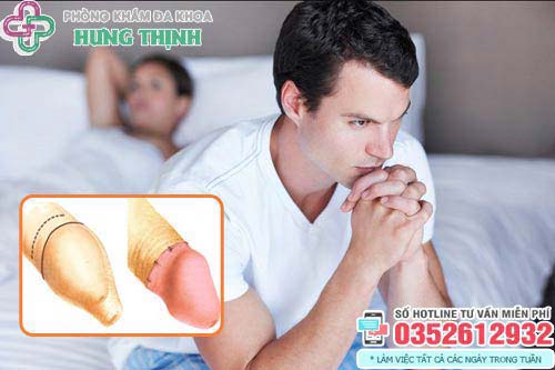 Top 12 địa chỉ cắt bao quy đầu ở đâu tốt nhất Hà Nội uy tín
